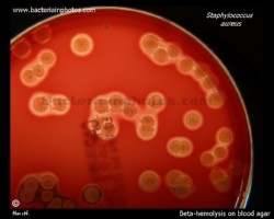 hemolytic colonies of staph aureus in Petri dish